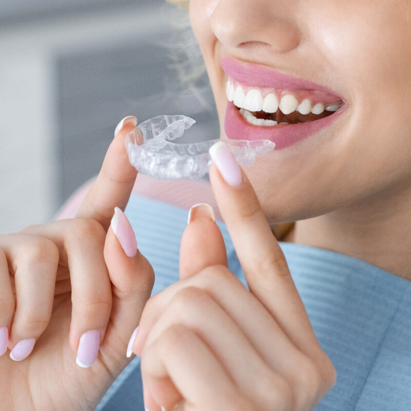 5 Tips for Keeping Your Teeth Clean During Clear Aligner Treatment