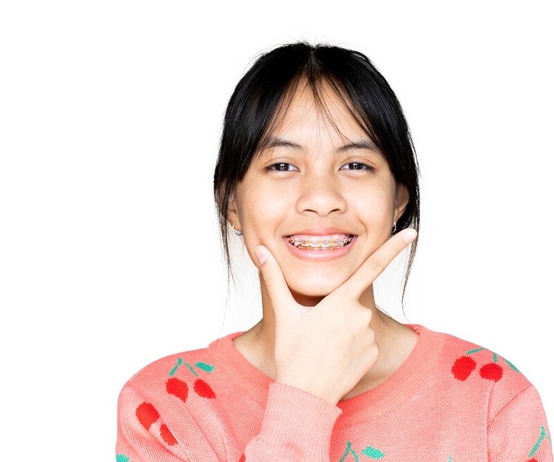 Teen girl smiling with metal braces showing early orthodontic results