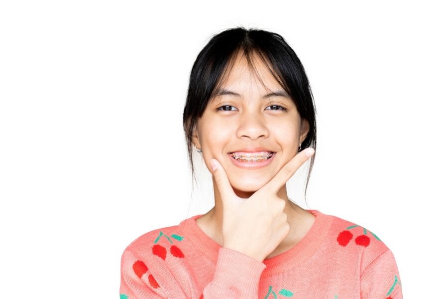 Teen girl smiling with metal braces showing early orthodontic results